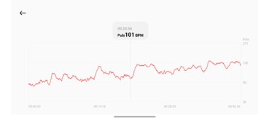 Xiaomi Smart Band 10 Pro ile Kalp Atış Hızı İzleme