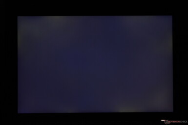 Kenarlar boyunca hafif-orta düzeyde düzensiz arka ışık kanaması